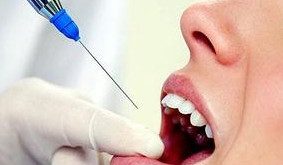 أضرار استخدام بنج الأسنان