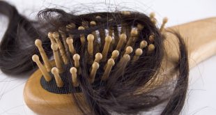 كيف تعالج تساقط الشعر عند النساء