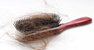 علاج تساقط الشعر بالأعشاب والزيوت الطبيعية