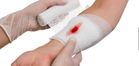كيفية علاج الجروح القطعية